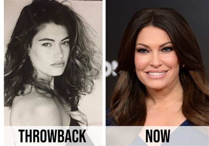 Kimberly Guilfoyle's Transformation: Before And After